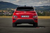 2021 Hyundai Kona 1.6 T-GDI 198 PS DCT N Line (4x2) galeri küçük görseli 3